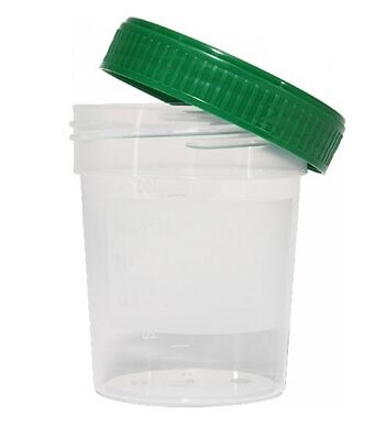 Urinebeker met groen schroefdeksel - 125 ml | 100 stuks
