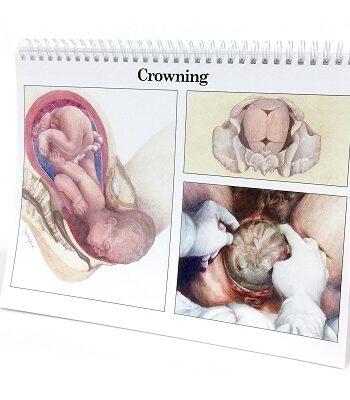 Childbirth Graphics-The Classic Series Flip-over