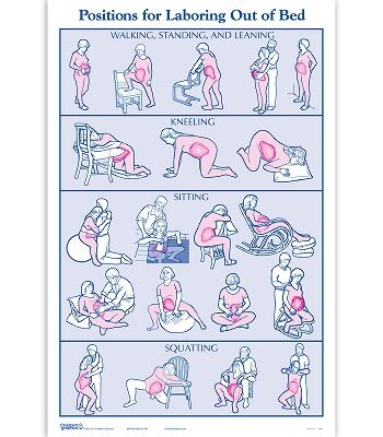 Childbirth Graphics-Kaart Bevalhoudingen